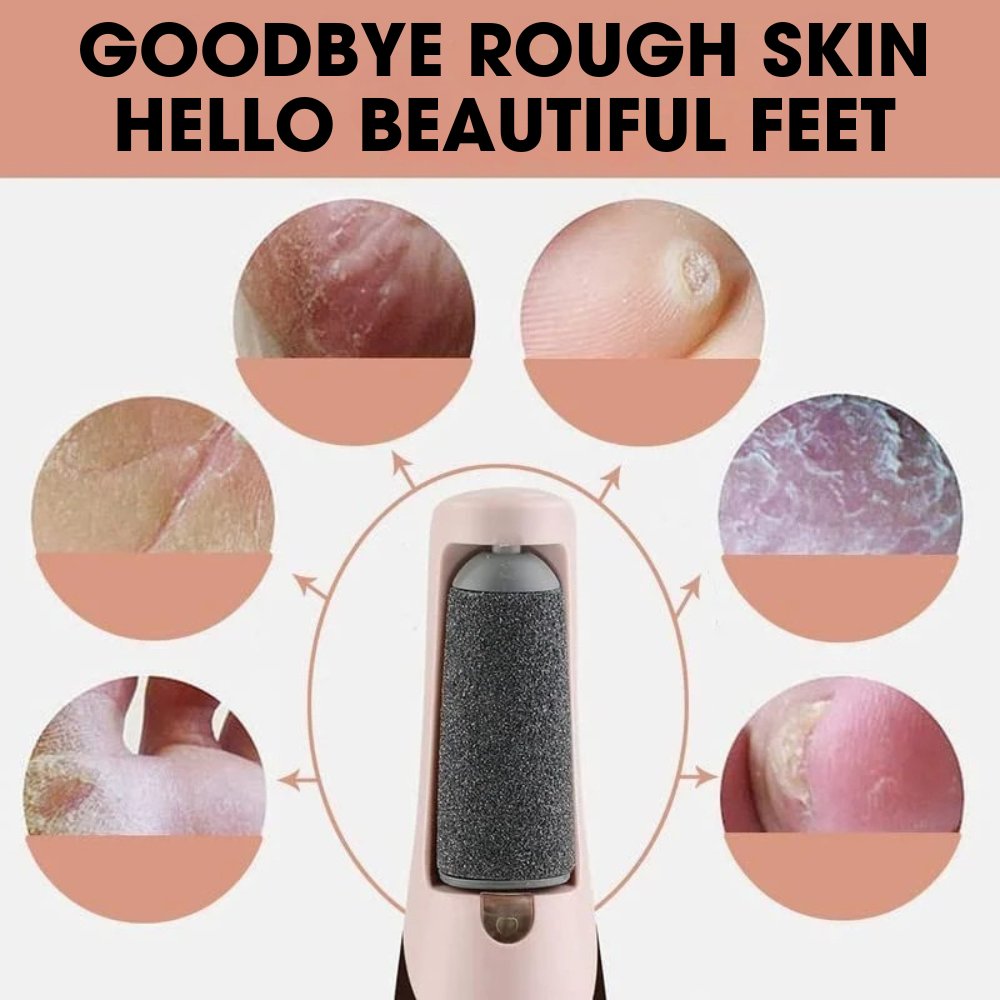 CalluCare™ | Electric callus remover