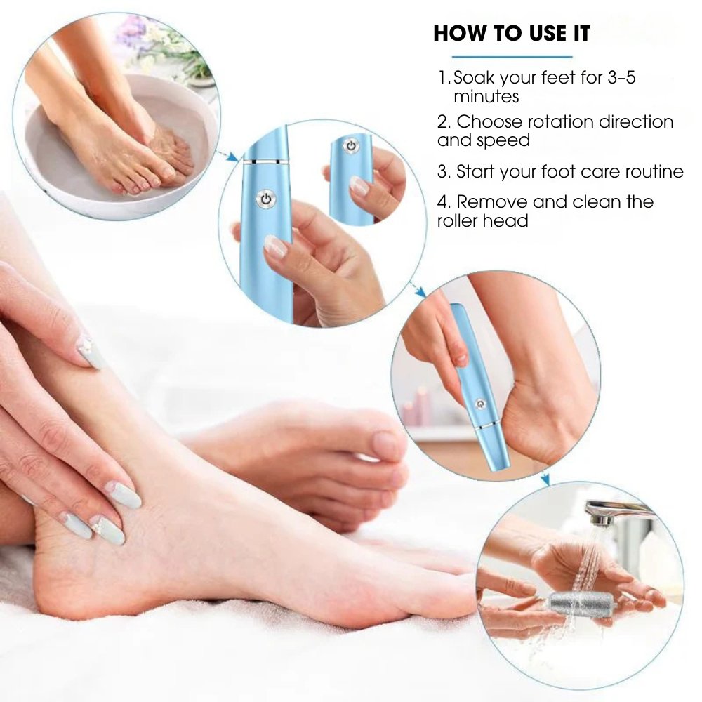 CalluCare™ | Electric callus remover