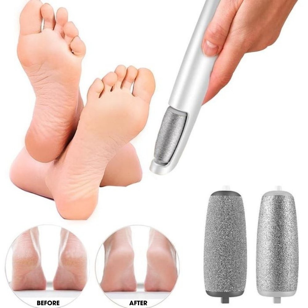 CalluCare™ | Electric callus remover